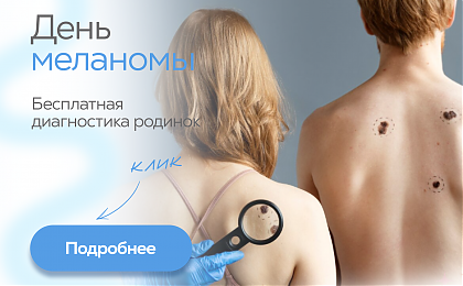 Обследуйте родинки-сохраните свою жизнь!